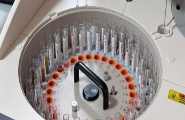Caraguatatuba ganha novo laboratório para exames do SUS