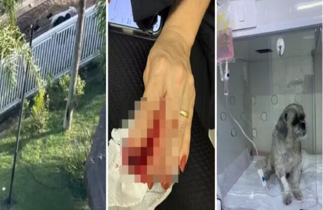 Mulher e cachorro ficam feridos após ataque de cão em São José dos Campos