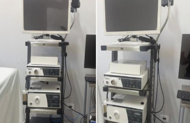Campos do Jordão — Saúde passa a fazer endoscopia e colonoscopia na rede municipal