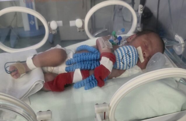 Polvinhos de crochê levam carinho aos bebês da UTI neonatal em São José