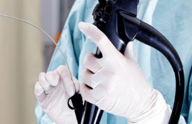 Taubaté agiliza agendamento de endoscopia nas unidades de saúde
